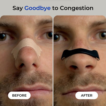BetterBreathe Nasal Relief Kit